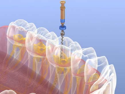 Endodonzia