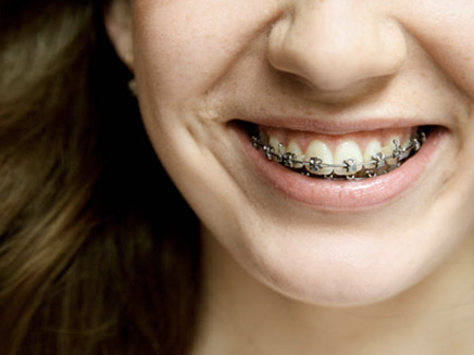 Cosmesi dentale