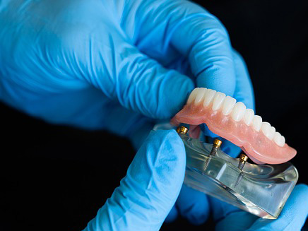 Cosmesi dentale